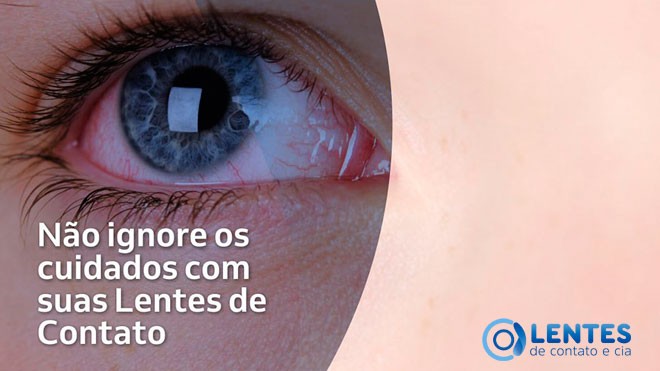 Dicas e cuidados com as lentes de contato